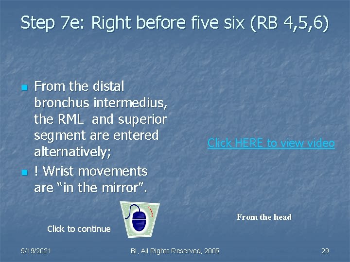 Step 7 e: Right before five six (RB 4, 5, 6) n n From