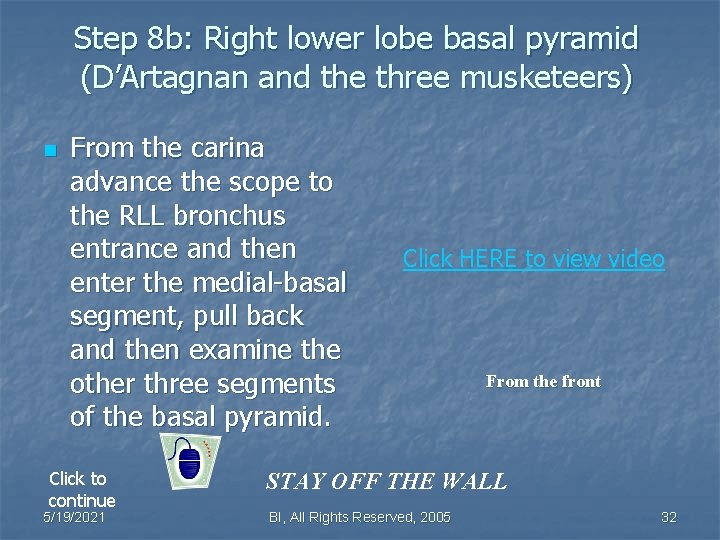 Step 8 b: Right lower lobe basal pyramid (D’Artagnan and the three musketeers) n