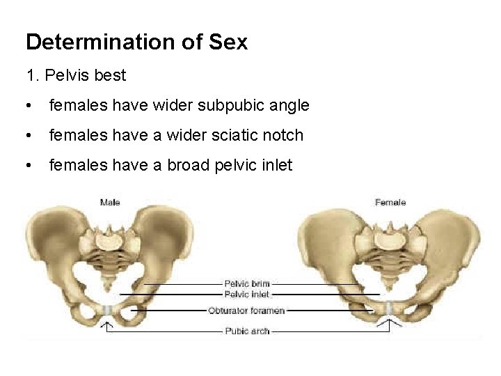 Determination of Sex 1. Pelvis best • females have wider subpubic angle • females Determination of Sex 1. Pelvis best • females have wider subpubic angle • females