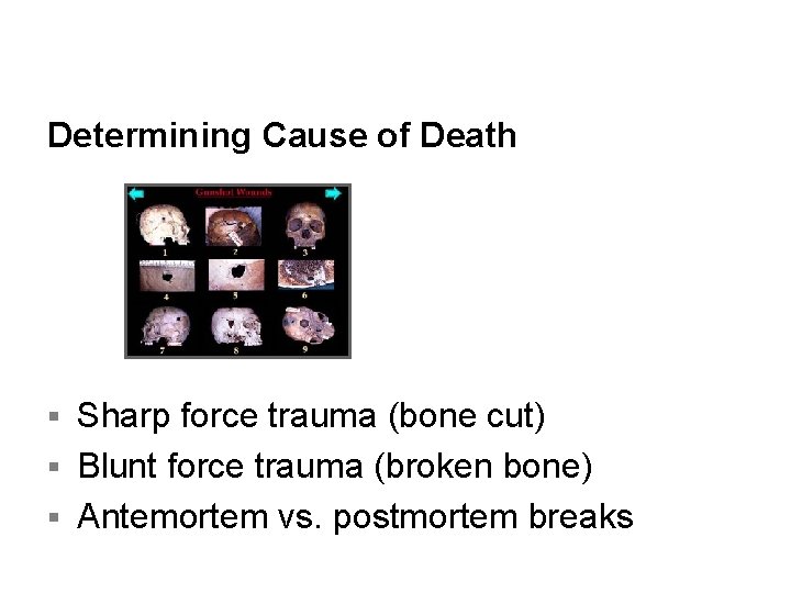Determining Cause of Death Sharp force trauma (bone cut) § Blunt force trauma (broken Determining Cause of Death Sharp force trauma (bone cut) § Blunt force trauma (broken