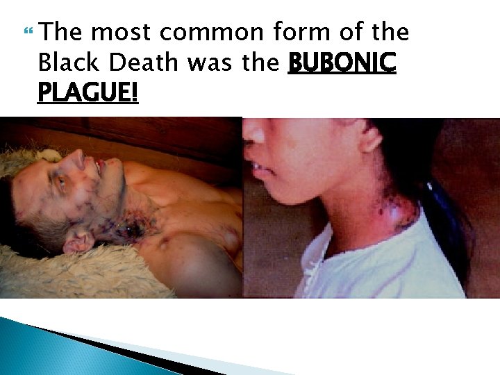  The most common form of the Black Death was the BUBONIC PLAGUE! 