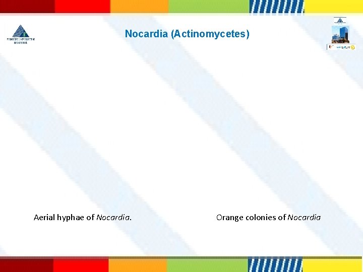 Nocardia (Actinomycetes) Aerial hyphae of Nocardia. Orange colonies of Nocardia 