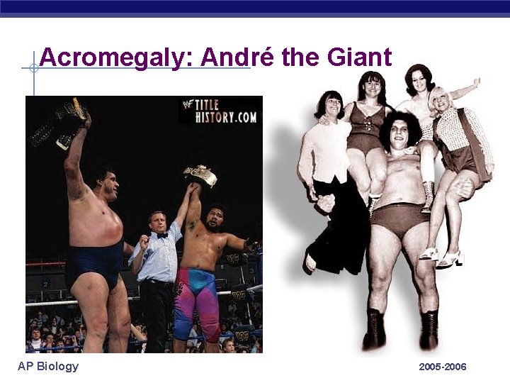 Acromegaly: André the Giant AP Biology 2005 -2006 