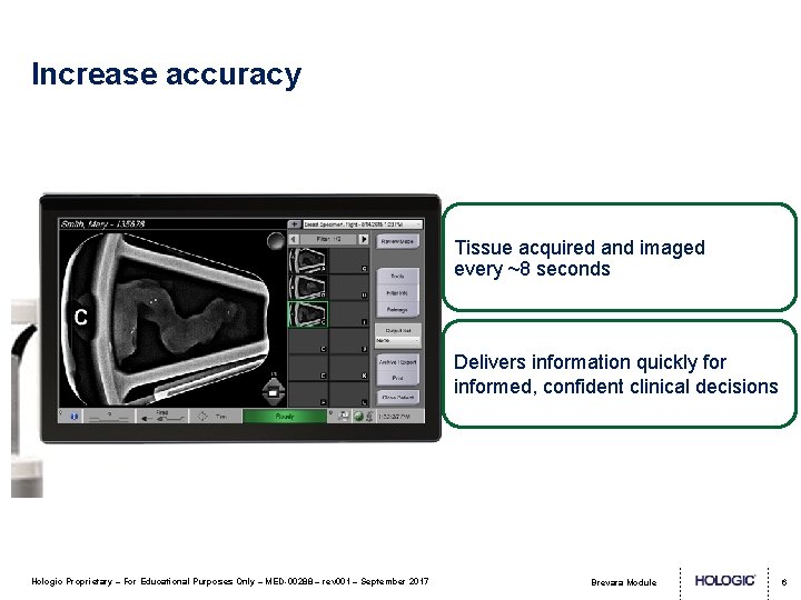 Increase accuracy Tissue acquired and imaged every ~8 seconds Delivers information quickly for informed,