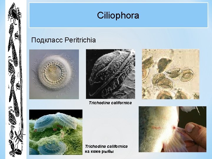 Ciliophora Подкласс Peritrichia Trichodina californica на коже рыбы 