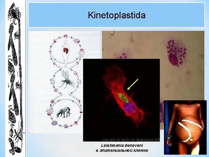 Kinetoplastida Leishmania donovani в эпителиальной клетке 