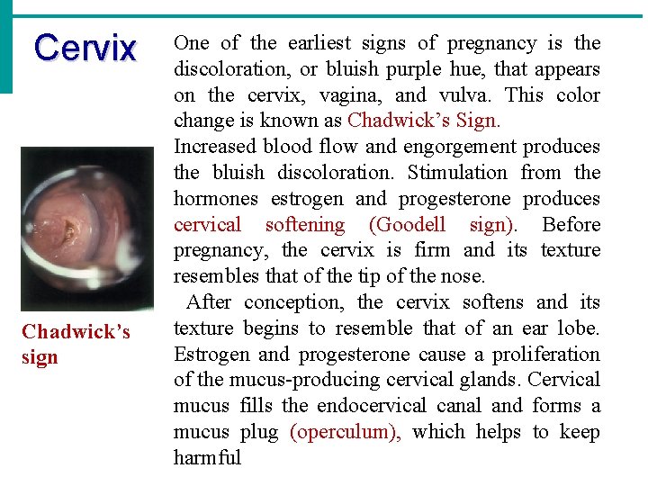 Cervix Chadwick’s sign One of the earliest signs of pregnancy is the discoloration, or