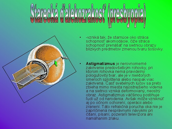  • -vzniká tak, že starnúce oko stráca schopnosť akomodácie, čiže stráca schopnosť prenášať