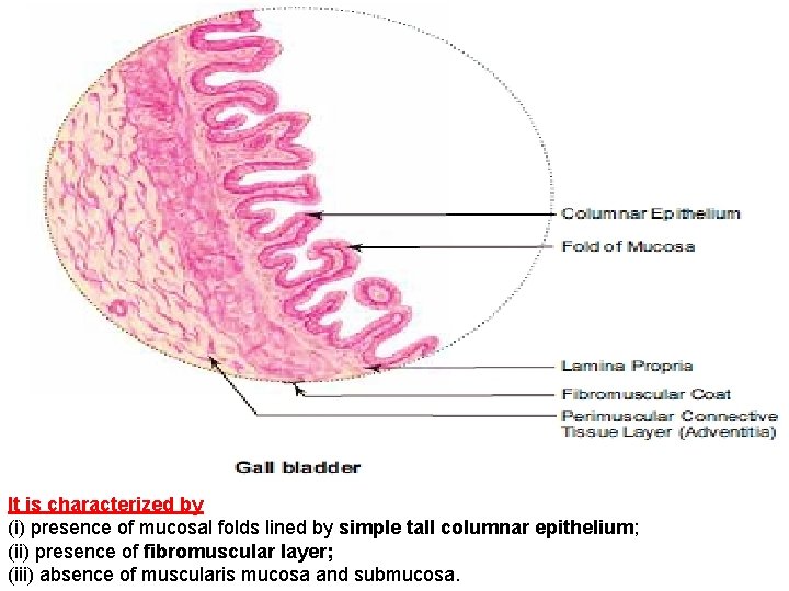 It is characterized by (i) presence of mucosal folds lined by simple tall columnar