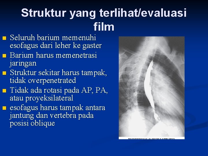 Struktur yang terlihat/evaluasi film n n n Seluruh barium memenuhi esofagus dari leher ke