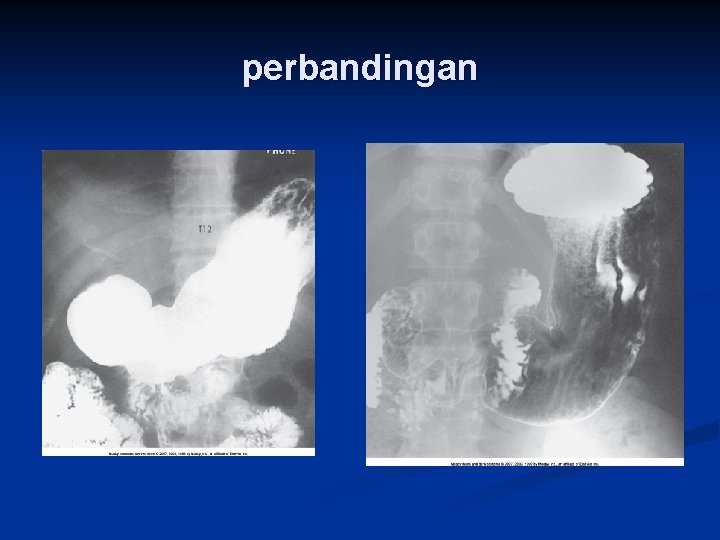 perbandingan 