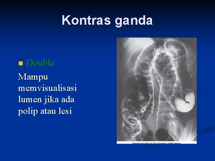 Kontras ganda Double Mampu memvisualisasi lumen jika ada polip atau lesi n 