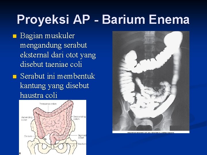 Proyeksi AP - Barium Enema n n Bagian muskuler mengandung serabut eksternal dari otot