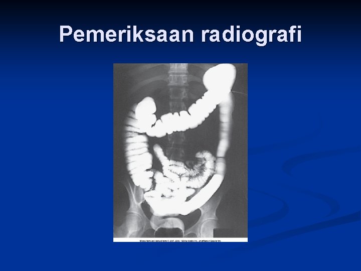 Pemeriksaan radiografi 