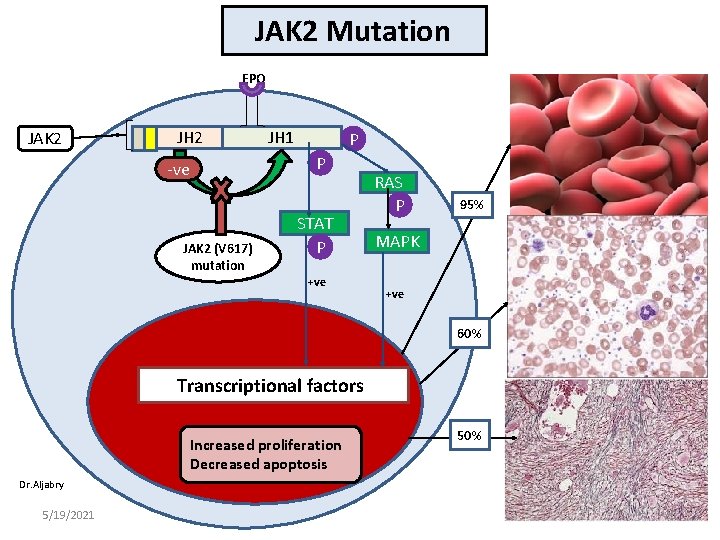 JAK 2 Mutation EPO JAK 2 JH 1 P P -ve JAK 2 (V