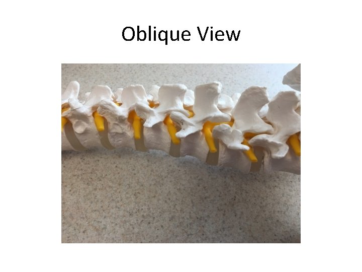 Oblique View 