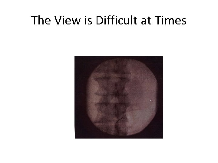 The View is Difficult at Times 