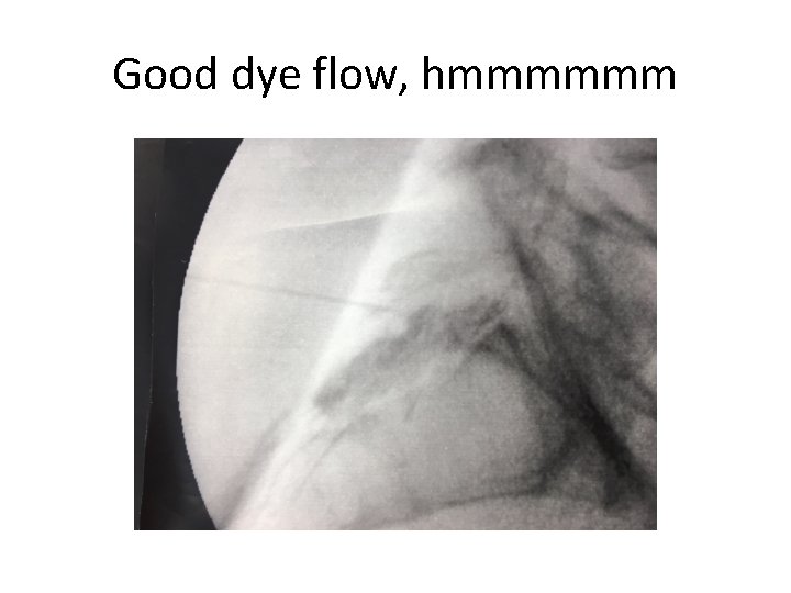 Good dye flow, hmmmmmm 