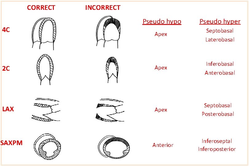 CORRECT INCORRECT Pseudo hypo Pseudo hyper Apex Septobasal Laterobasal 2 C Apex Inferobasal Anterobasal