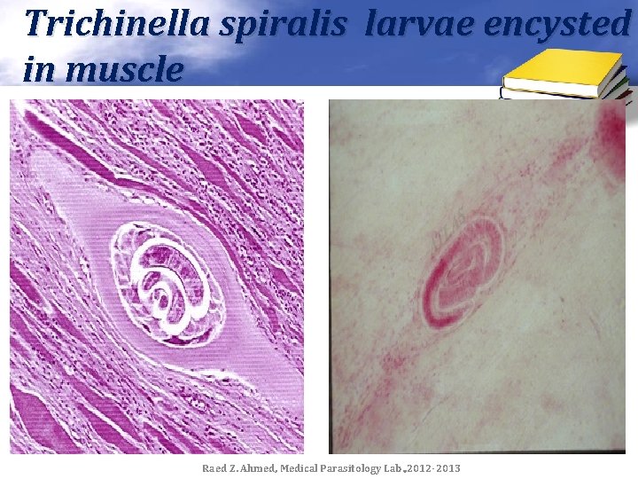 Trichinella spiralis larvae encysted in muscle Raed Z. Ahmed, Medical Parasitology Lab. , 2012