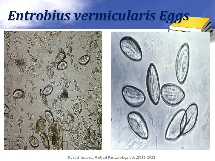 Entrobius vermicularis Eggs Raed Z. Ahmed, Medical Parasitology Lab. , 2012 -2013 