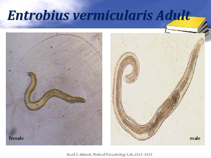 Entrobius vermicularis Adult female Raed Z. Ahmed, Medical Parasitology Lab. , 2012 -2013 