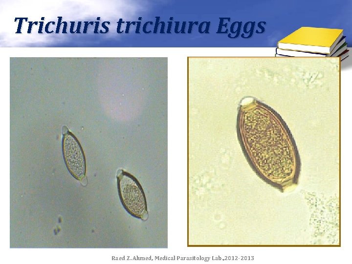 Trichuris trichiura Eggs Raed Z. Ahmed, Medical Parasitology Lab. , 2012 -2013 