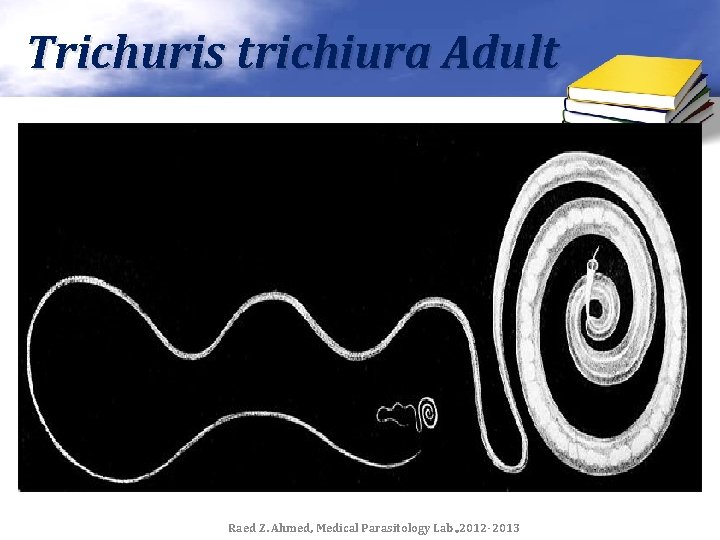 Trichuris trichiura Adult Raed Z. Ahmed, Medical Parasitology Lab. , 2012 -2013 