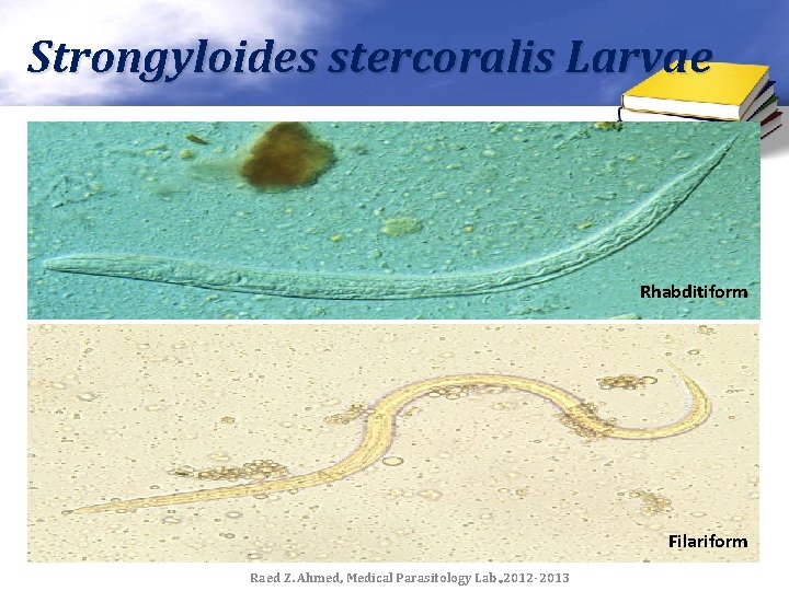 Strongyloides stercoralis Larvae Rhabditiform Filariform Raed Z. Ahmed, Medical Parasitology Lab. , 2012 -2013