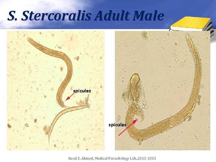 S. Stercoralis Adult Male spicules Raed Z. Ahmed, Medical Parasitology Lab. , 2012 -2013