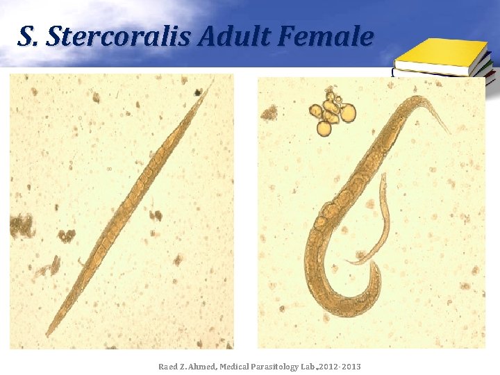 S. Stercoralis Adult Female Raed Z. Ahmed, Medical Parasitology Lab. , 2012 -2013 