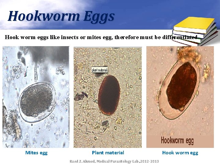 Hookworm Eggs Hook worm eggs like insects or mites egg, therefore must be differentiated