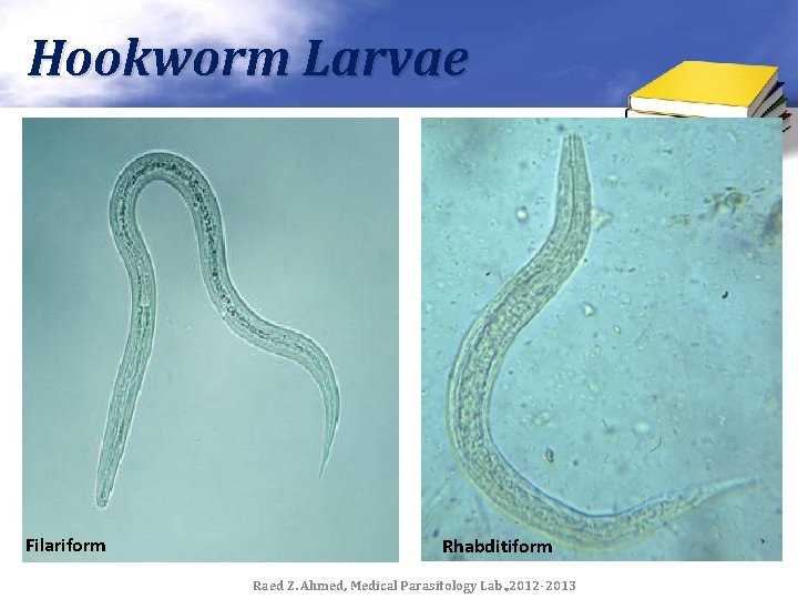Hookworm Larvae Filariform Rhabditiform Raed Z. Ahmed, Medical Parasitology Lab. , 2012 -2013 