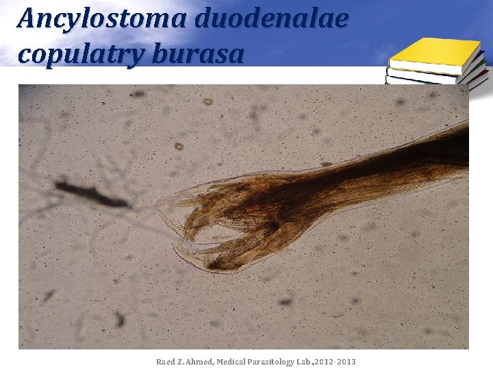 Ancylostoma duodenalae copulatry burasa Raed Z. Ahmed, Medical Parasitology Lab. , 2012 -2013 