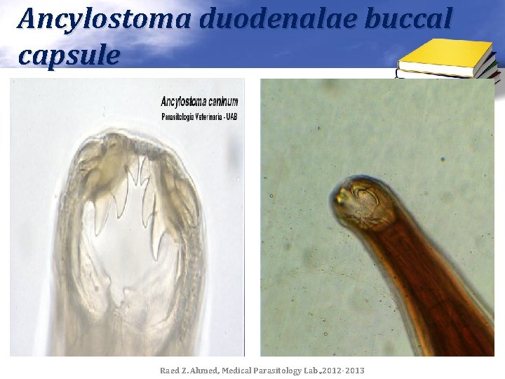 Ancylostoma duodenalae buccal capsule Raed Z. Ahmed, Medical Parasitology Lab. , 2012 -2013 