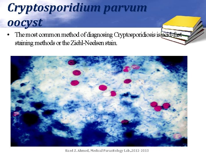 Cryptosporidium parvum oocyst • The most common method of diagnosing Cryptosporidiosis is acid-fast staining