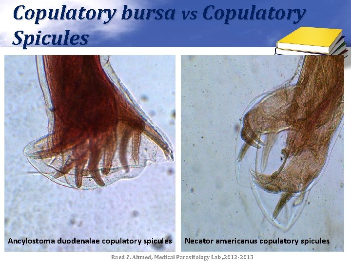 Copulatory bursa vs Copulatory Spicules Ancylostoma duodenalae copulatory spicules Necator americanus copulatory spicules Raed