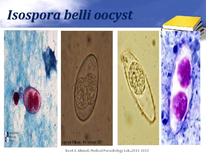 Isospora belli oocyst Raed Z. Ahmed, Medical Parasitology Lab. , 2012 -2013 