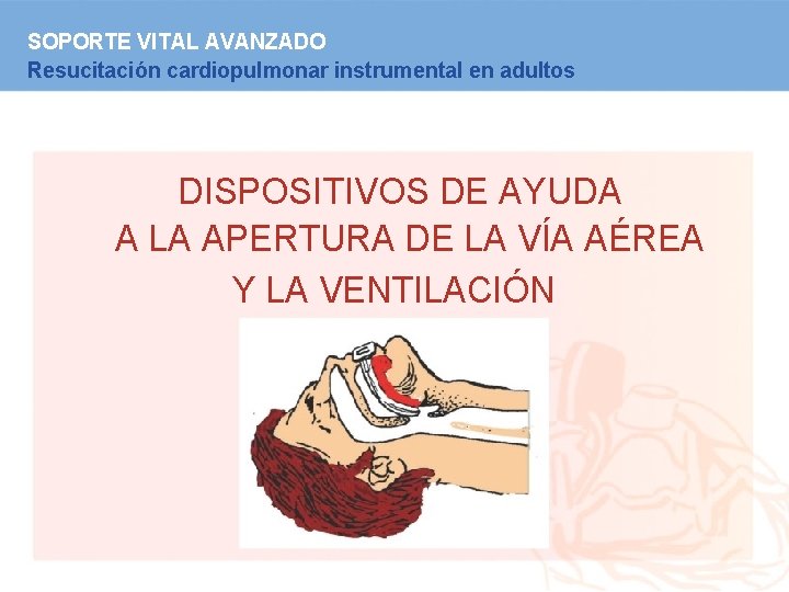 SOPORTE VITAL AVANZADO Resucitación cardiopulmonar instrumental en adultos DISPOSITIVOS DE AYUDA A LA APERTURA