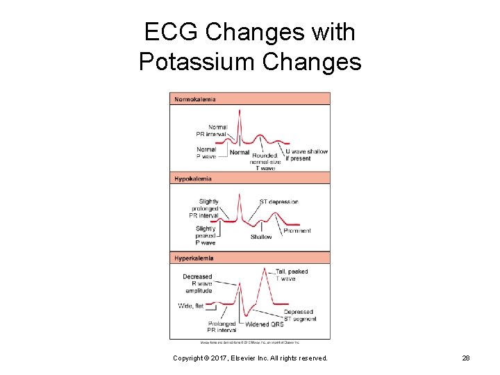 ECG Changes with Potassium Changes Copyright © 2017, Elsevier Inc. All rights reserved. 28