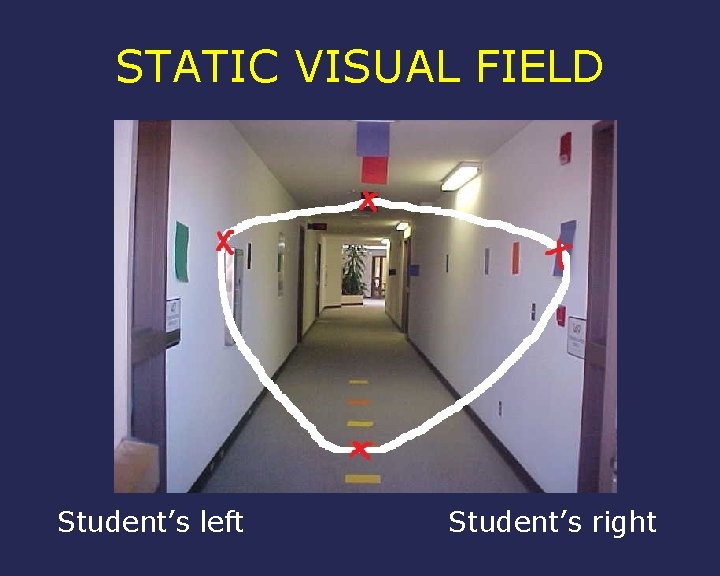 STATIC VISUAL FIELD Student’s left Student’s right 