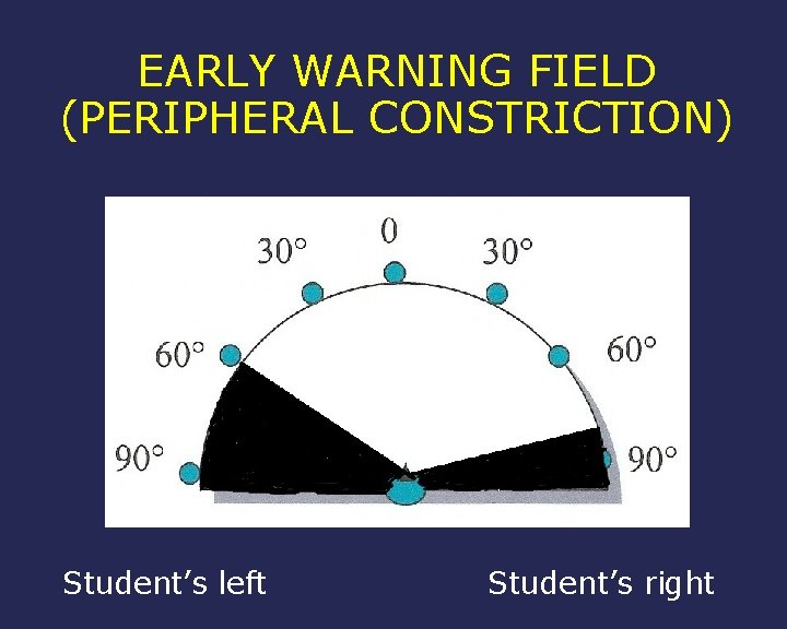 EARLY WARNING FIELD (PERIPHERAL CONSTRICTION) Student’s left Student’s right 