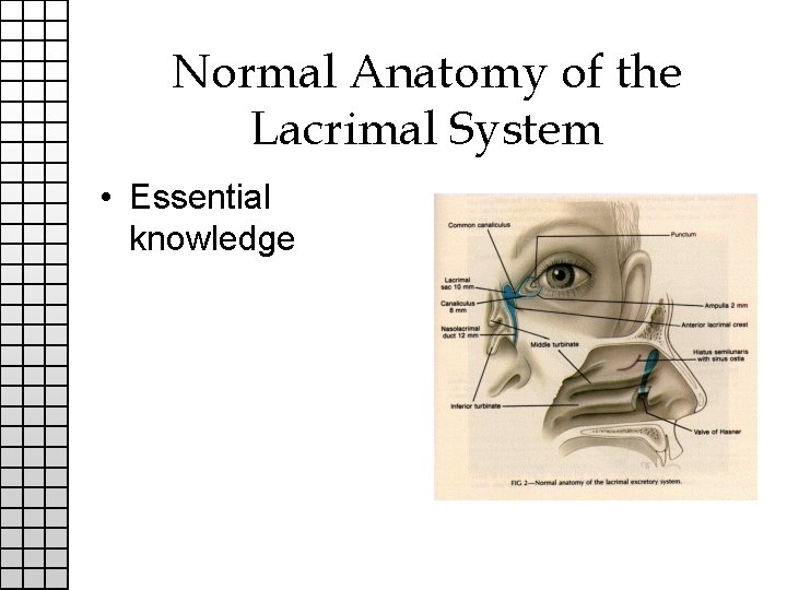 Normal Anatomy of the Lacrimal System • Essential knowledge 