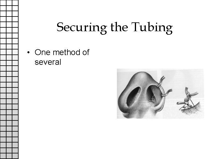 Securing the Tubing • One method of several 