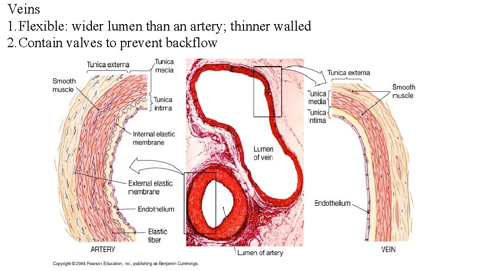 Veins 1. Flexible: wider lumen than an artery; thinner walled 2. Contain valves to