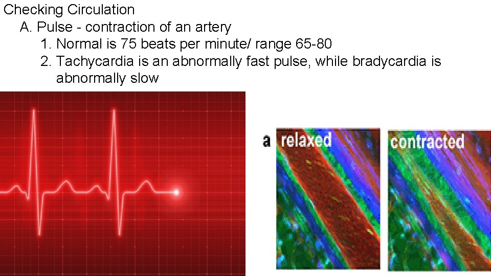 Checking Circulation A. Pulse - contraction of an artery 1. Normal is 75 beats