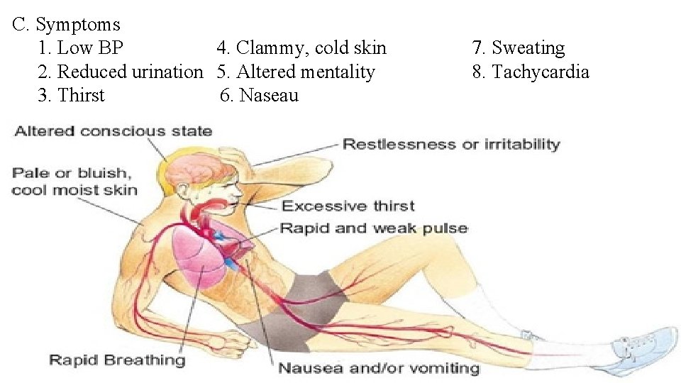 C. Symptoms 1. Low BP 4. Clammy, cold skin 2. Reduced urination 5. Altered
