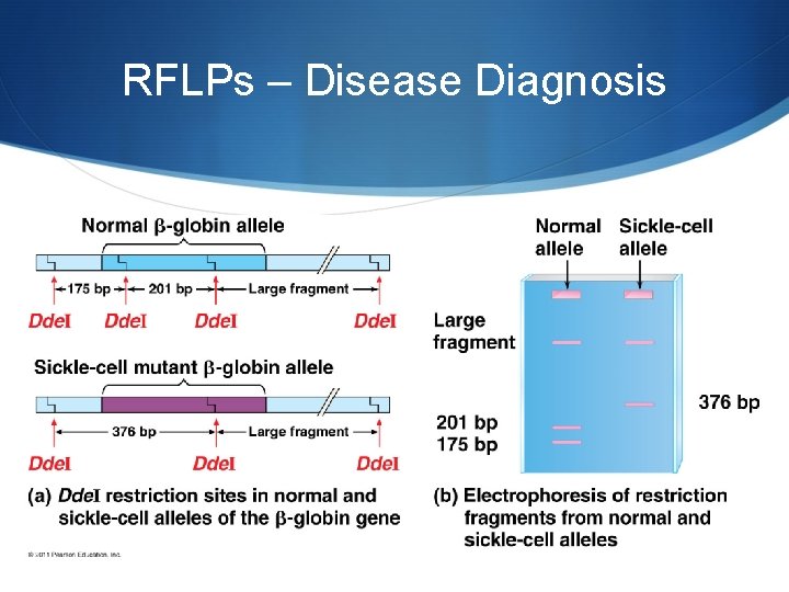 RFLPs – Disease Diagnosis 