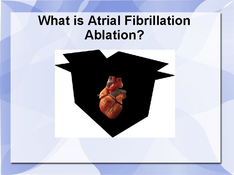 What is Atrial Fibrillation Ablation? 