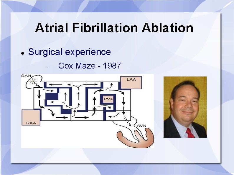 Atrial Fibrillation Ablation Surgical experience Cox Maze - 1987 